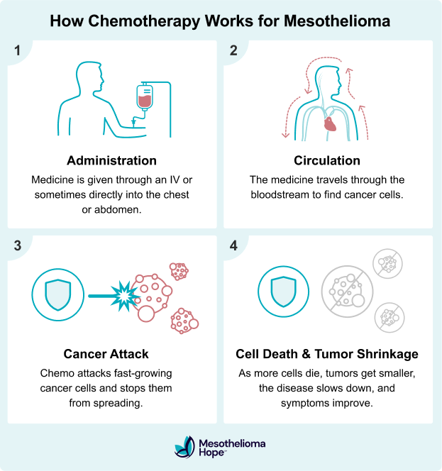 Infographic explaining how chemotherapy works for mesothelioma in four steps